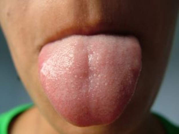 Tongue